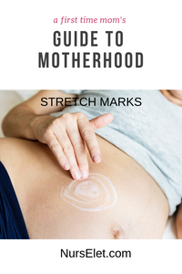 A First Time Mom's Guide to Motherhood | Chapter 3 Stretch Marks